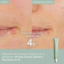 Caudalie Vinopure Stop Granos 15 ml