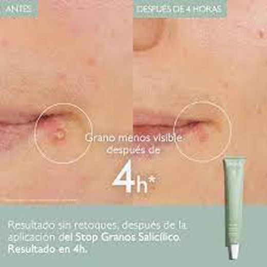 Caudalie Vinopure Stop Granos 15 ml