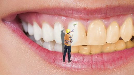 Kit Dental Blanqueador LacerBlanc White Flash