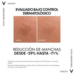 Liftactiv Serum B31 Antimanchas Envase 30ml