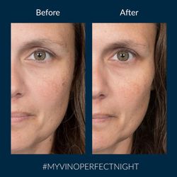 Vinoperfect Crema Noche Glicólica Antimanchas - 40 mL