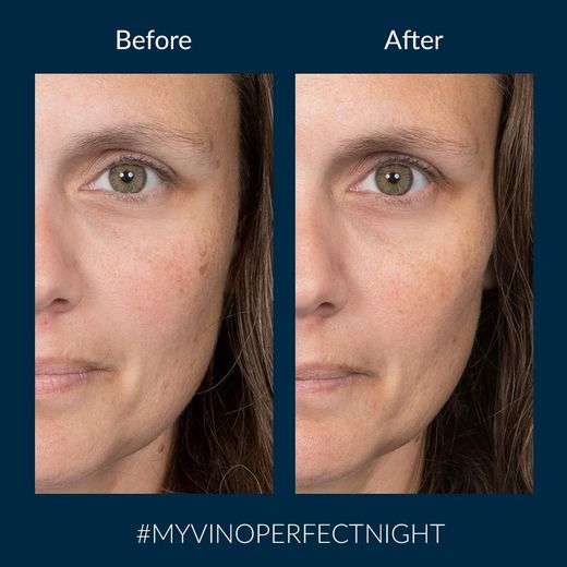 Vinoperfect Crema Noche Glicólica Antimanchas - 40 mL